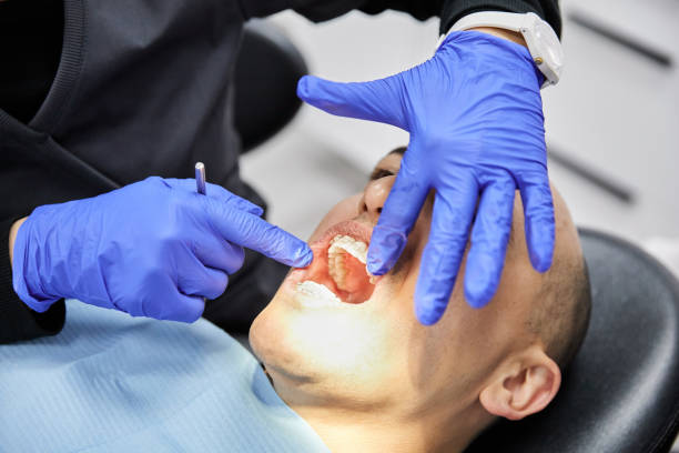 Best Emergency Treatment for Dental Infections or Abscesses in Mccom, MS